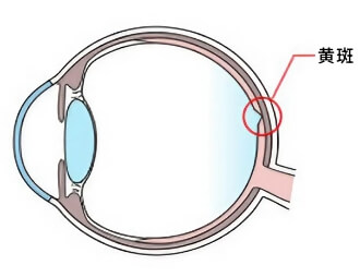 黄斑変性症のイメージ画像