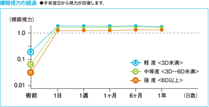 裸眼視力の経過イメージの画像